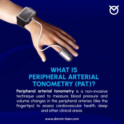 Peripheral Arterial Tonometry (PAT) vs. Photoplethysmography (PPG)